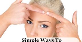 Simple Ways to Get rid of White Heads