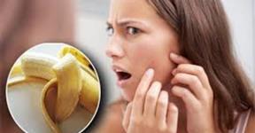 Banana Peels Helps you In Getting Rid Of Acne And Wrinkles Of The Face