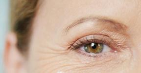 Eye Treatment For Wrinkles