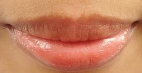 How To Lighten Dark Lips With Home Remedies