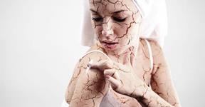 Essential Common Facts to be Know About Dry Skin