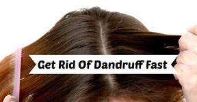 Home Remedies To Get Rid Of Dandruff By Dr. Bilquis