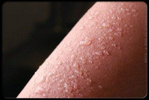 What Are The Symptoms Of Sunburn?